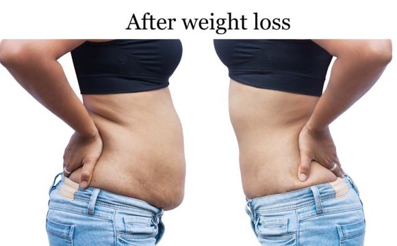 Benefits of HCG drops for weight loss