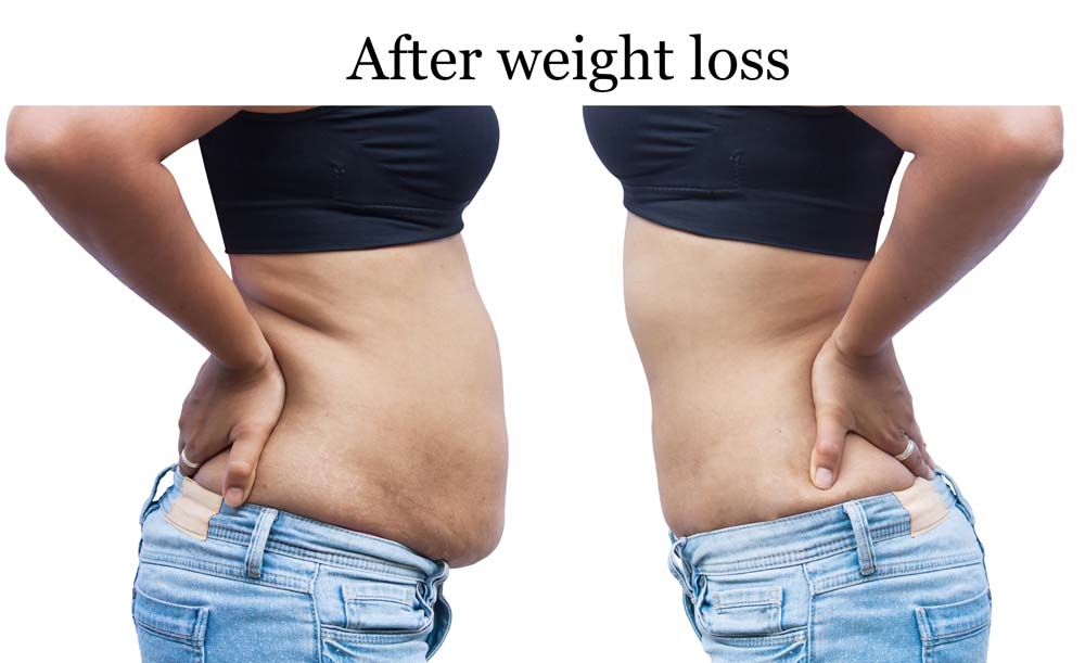 Benefits of HCG drops for weight loss
