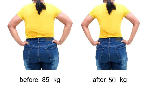 Dr Emma`s hCG diet protocol result